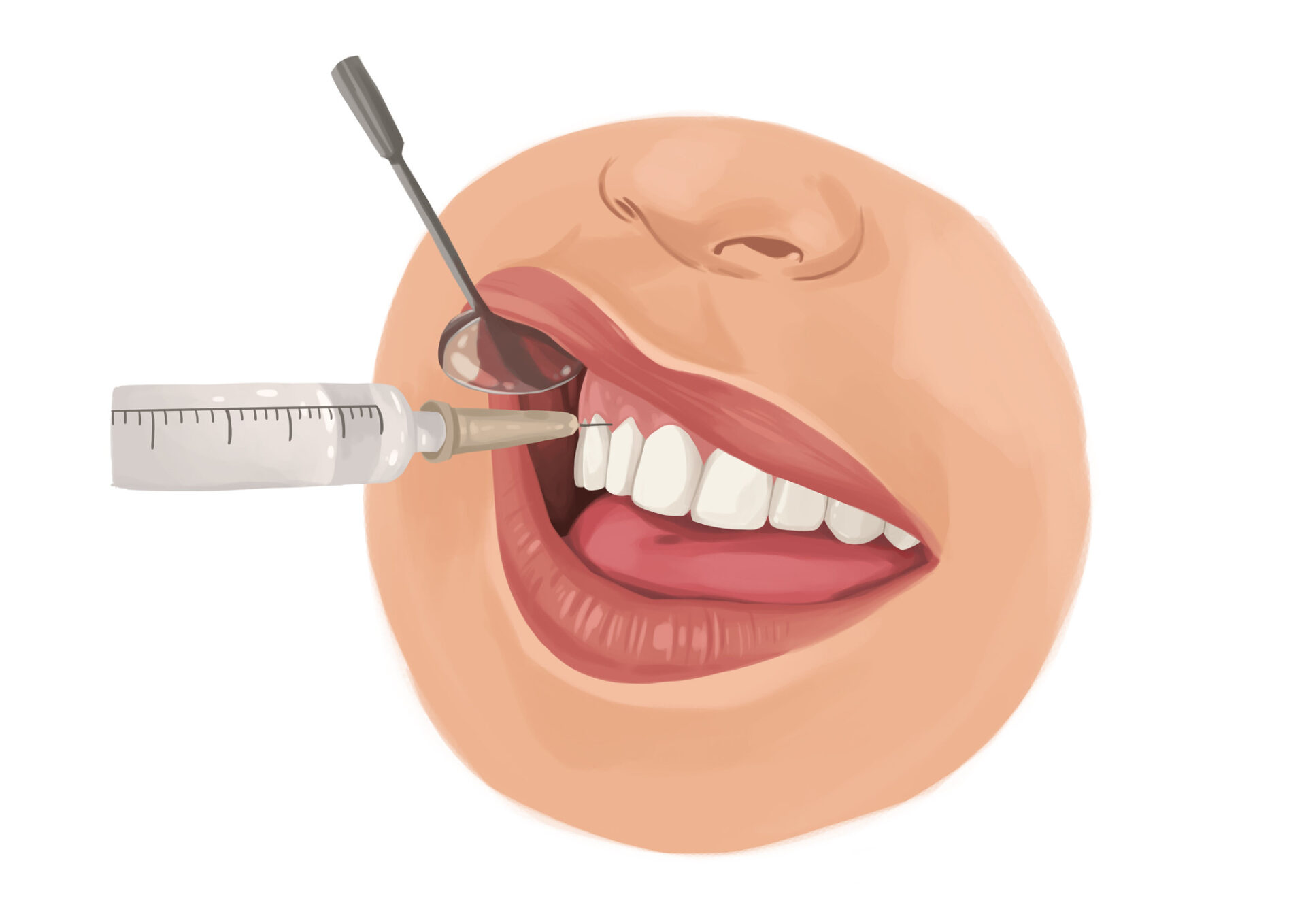 local anesthesia for deep cleaning, deep cleaning, non-surgical periodontal therapy, gum disease, Lynn Lane Family Dentistry, oral health, dental hygiene, Broken Arrow OK, dental care, plaque and tartar removal