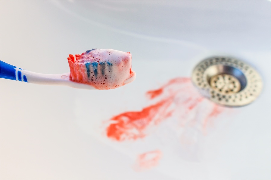 blood on toothbrush to show bleeding gums after brushing or flossing, why do gums bleed